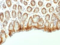 Formalin-fixed, paraffin embedded mouse colon sections stained with 100 ul anti-Beta Catenin (clone CTNNB1/1507) at 1:300. HIER epitope retrieval prior to staining was performed in 10mM Tris 1mM EDTA, pH 9.0.